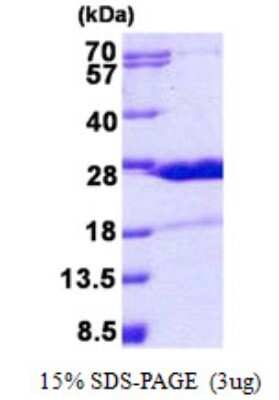 SDS-PAGE Recombinant Human HN1 His Protein