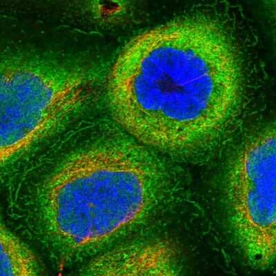 Immunocytochemistry/Immunofluorescence: HN1L Antibody [NBP1-88446] - Staining of human cell line A-431 shows localization to plasma membrane & cytosol. Antibody staining is shown in green.