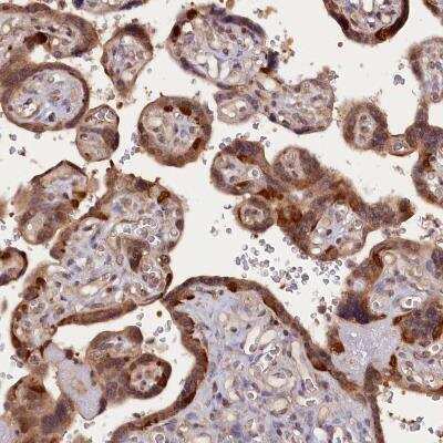 Immunohistochemistry-Paraffin: HN1L Antibody [NBP1-88446] - Staining of human placenta shows moderate cytoplamic positivity in trophoblastic cells.