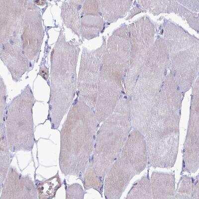 Immunohistochemistry-Paraffin: HN1L Antibody [NBP1-88446] - Staining of human skeletal muscle shows no positivity in myocytes as expected.