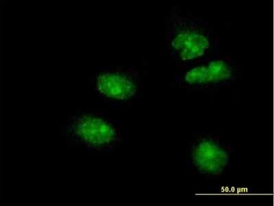 Immunocytochemistry/Immunofluorescence: HNF-3 beta/FoxA2 Antibody (4G11) [H00003170-M11] - Analysis of monoclonal antibody to FOXA2 on HeLa cell. Antibody concentration 10 ug/ml