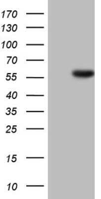 Western Blot: HNF-4 alpha/NR2A1 Antibody (OTI2H2) - Azide and BSA Free [NBP2-70905] - Analysis of HEK293T cells were transfected with the pCMV6-ENTRY control (Left lane) or pCMV6-ENTRY HNF-4 alpha.