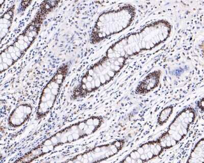 Immunohistochemistry-Paraffin: HNF-4 alpha/NR2A1 Antibody (SN72-03) [NBP2-67679] - Analysis of paraffin-embedded human small intestine tissue with Rabbit anti-HNF-4 alpha/NR2A1 antibody washed with ddH2O and PBS, and then probed with the primary antibody at 1/200 dilution for 1 hour at room temperature. The detection was performed using an HRP conjugated compact polymer system. DAB was used as the chromogen. Tissues were counterstained with hematoxylin and mounted with DPX.