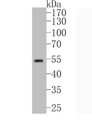 Western Blot: HNF-4 alpha/NR2A1 Antibody (SN72-03) [NBP2-67679] - Analysis of HNF-4-alpha on A549 cell lysates. Proteins were transferred to a PVDF membrane and blocked with 5% BSA in PBS for 1 hour at room temperature. The primary antibody (1/500) was used in 5% BSA at room temperature for 2 hours. Goat Anti-Rabbit IgG - HRP Secondary Antibody at 1:5,000 dilution was used for 1 hour at room temperature.