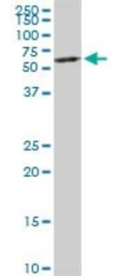 Western Blot: HNF-4 alpha/NR2A1 Antibody [H00003172-D01P] - Analysis of HNF4A expression in HeLa.