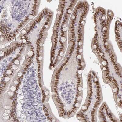 Immunohistochemistry-Paraffin HNF-4 gamma/NR2A2 Antibody - BSA Free
