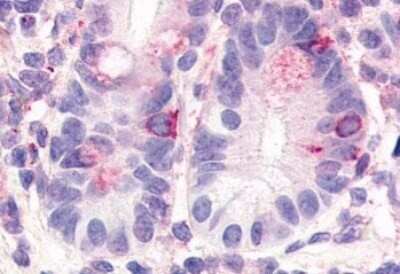 Immunohistochemistry-Paraffin: HNF-4 gamma/NR2A2 Antibody [NLS5162] - Anti-HNF4G antibody IHC of human small intestine. Immunohistochemistry of formalin-fixed, paraffin-embedded tissue after heat-induced antigen retrieval.