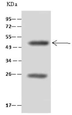 Immunoprecipitation: HNF-4 gamma/NR2A2 Antibody [NBP2-98899] - HNF-4 gamma/NR2A2 was immunoprecipitated using: Lane A: 0.5 mg mouse spleen tissue Lysate 4 ul anti-HNF-4 gamma/NR2A2 rabbit polyclonal antibody and 60 ug of Immunomagnetic beads. Protein A/G. Primary antibody: Anti-HNF-4 gamma/NR2A2 rabbit polyclonal antibody, at 1:100 dilution. Secondary antibody: Clean-Blot IP Detection Reagent (HRP) at 1:1000 dilution. Developed using the ECL technique. Performed under reducing conditions. Predicted band size: 46 kDa. Observed band size: 46 kDa