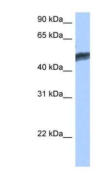 Western Blot: HNF-4 gamma/NR2A2 Antibody [NBP1-52810] - MCF-7 whole cell lysates, concentration 0.2-1 ug/ml.