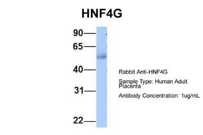Western Blot: HNF-4 gamma/NR2A2 Antibody [NBP1-52810] - Human Adult Placenta Antibody Dilution: 1.0 ug/ml.