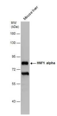 Western Blot: HNF1 Antibody (4110) [NBP2-43652] - Mouse tissue extract (50 ug) was separated by 7.5% SDS-PAGE, and the membrane was blotted with HNF1 alpha antibody (4110) diluted at 1:2000. The HRP-conjugated anti-mouse IgG antibody was used to detect the primary antibody, and the signal was developed with Trident ECL plus-Enhanced.