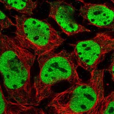 Immunocytochemistry/Immunofluorescence: HNF1 Antibody [NBP2-38243] - Staining of human cell line CACO-2 shows localization to nucleoplasm. Antibody staining is shown in green.