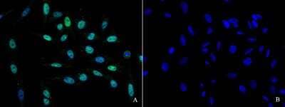 Immunocytochemistry/Immunofluorescence: HNF1 Antibody [NBP2-98696] - Immunofluorescence staining of HNF1 in HeLa cells. Cells were fixed with 4% PFA, blocked with 10% serum. Then incubated with rabbit anti-human HNF1 polyclonal antibody (1:1000)(Figure A), incubated with rabbit anti-human HNF1 polyclonal antibody and antigen (Figure B) at 4C overnight. Then cells were stained with the Alexa Fluor(R)488-conjugated Goat Anti-rabbit IgG Secondary antibody (green) and counterstained with DAPI (blue). Positive staining was localized to nucleus.