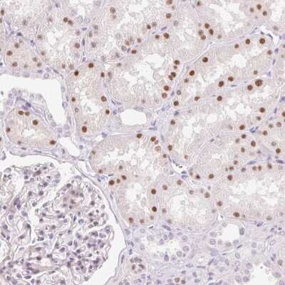 Immunohistochemistry-Paraffin: HNF1 Antibody [NBP2-38243] - Staining of human kidney shows moderate nuclear positivity in cells in tubules.