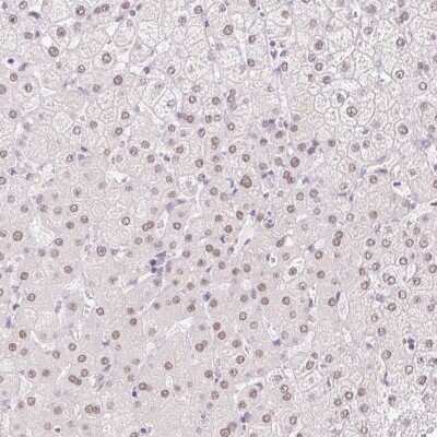 Immunohistochemistry-Paraffin: HNF1 Antibody [NBP2-38243] - Staining of human liver shows weak nuclear positivity in hepatocytes.