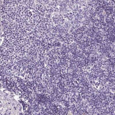 Immunohistochemistry-Paraffin: HNF1 Antibody [NBP2-38243] - Staining of human lymph node shows no positivity in lymphoid cells.