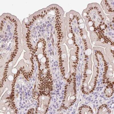 Immunohistochemistry-Paraffin: HNF1 Antibody [NBP2-38243] - Staining of human small intestine shows strong nuclear positivity in glandular cells.