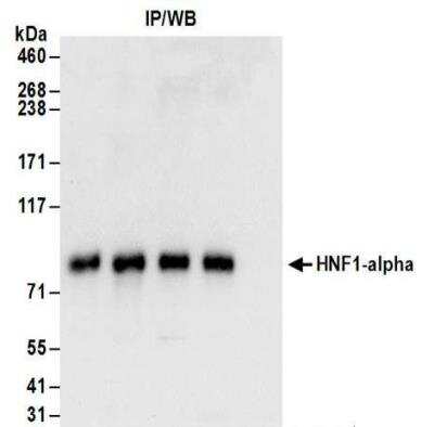 Immunoprecipitation: HNF1 Antibody [NBP2-32125] - Samples: Whole cell lysate (50 ug) from Hep G2 cells. Antibodies: Affinity purified rabbit anti-HNF1-alpha antibody NBP2-32125 used for WB at 0.1 ug/ml. Detection: Chemiluminescence with an exposure time of 30 seconds.