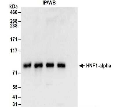 Immunoprecipitation: HNF1 Antibody [NBP2-32126] - Whole cell lysate (1 mg for IP; 20% of IP loaded) from Hep G2 cells. Antibodies:  Affinity purified rabbit anti-HNF1-alpha antibody NBP2-32126used for IP at 6 ug/mg lysate.  HNF1-alpha was also immunoprecipitated by rabbit anti-HNF1-alpha antibodies NBP2-32123, NBP2-32124, NBP2-32126. For blotting immunoprecipitated NBP2-32126 was used at 1 ug/ml. Detection: Chemiluminescence with an exposure time of 3 seconds.