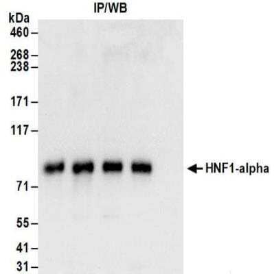 Western Blot: HNF1 Antibody [NBP2-32123] - Samples: Whole cell lysate (1 mg for IP; 20% of IP loaded) from Hep G2 cells. Antibodies: Affinity purified rabbit anti-HNF1-alpha antibody NBP2-32123 used for IP at 6 ug/mg lysate. HNF1-alpha was also immunoprecipitated by rabbit anti-HNF1-alpha antibodies NBP2-32124, NBP2-32125, NBP2-32126. For blotting immunoprecipitated HNF1-alpha, NBP2-32125 was used at 1 ug/ml. Detection: Chemiluminescence with an exposure time of 3 seconds.