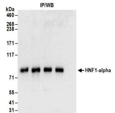 Western Blot: HNF1 Antibody [NBP2-32124] - Samples: Whole cell lysate (1 mg for IP; 20% of IP loaded) from Hep G2 cells. Antibodies: Affinity purified rabbit anti-HNF1-alpha antibody NBP2-32124 used for IP at 6 ug/mg lysate. HNF1-alpha was also immunoprecipitated by rabbit anti-HNF1-alpha antibodies NBP2-32123, NBP2-32125, NBP2-32126. For blotting immunoprecipitated HNF1-alpha, NBP2-32125 was used at 1 ug/ml. Detection: Chemiluminescence with an exposure time of 3 seconds.