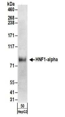 Western Blot: HNF1 Antibody [NBP2-32125] - Samples:  Whole cell lysate (50 ug) from Hep G2 cells.   Antibodies:  Affinity purified rabbit anti-HNF1-alpha antibody NBP2-32125 used for WB at 0.1 ug/ml.  Detection: Chemiluminescence with an exposure time of 30 seconds.