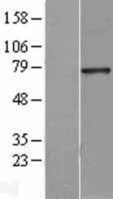 Western Blot: HNF1 Overexpression Lysate (Adult Normal) [NBL1-11630] Left-Empty vector transfected control cell lysate (HEK293 cell lysate); Right -Over-expression Lysate for HNF1.