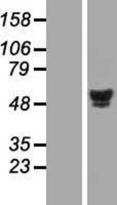 Western Blot: HNF4 alpha Overexpression Lysate (Adult Normal) [NBL1-11632] Left-Empty vector transfected control cell lysate (HEK293 cell lysate); Right -Over-expression Lysate for HNF4 alpha.