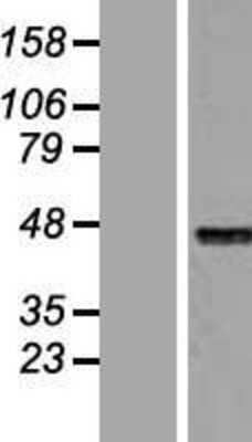 Western Blot: HNF4 alpha Overexpression Lysate (Adult Normal) [NBP2-04948] Left-Empty vector transfected control cell lysate (HEK293 cell lysate); Right -Over-expression Lysate for HNF4 alpha.