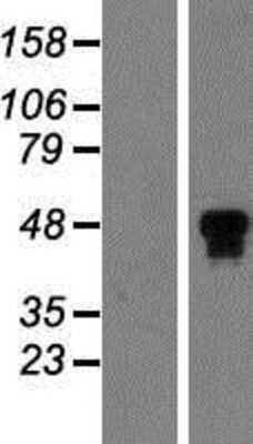 Western Blot: HNF4 alpha Overexpression Lysate (Adult Normal) [NBP2-11217] Left-Empty vector transfected control cell lysate (HEK293 cell lysate); Right -Over-expression Lysate for HNF4 alpha.