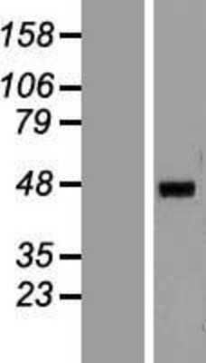 Western Blot: HNF4 alpha Overexpression Lysate (Adult Normal) [NBP2-11605] Left-Empty vector transfected control cell lysate (HEK293 cell lysate); Right -Over-expression Lysate for HNF4 alpha.