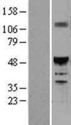 Western Blot: HNF6 Overexpression Lysate (Adult Normal) [NBL1-13936] Left-Empty vector transfected control cell lysate (HEK293 cell lysate); Right -Over-expression Lysate for HNF6.