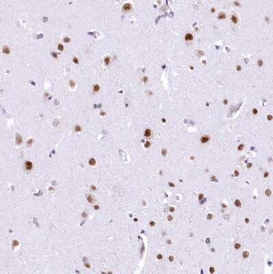 Immunohistochemistry-Paraffin: HNRNPA0 Antibody [NBP1-83240] - Staining of human cerebral cortex shows strong nuclear positivity in neurons.