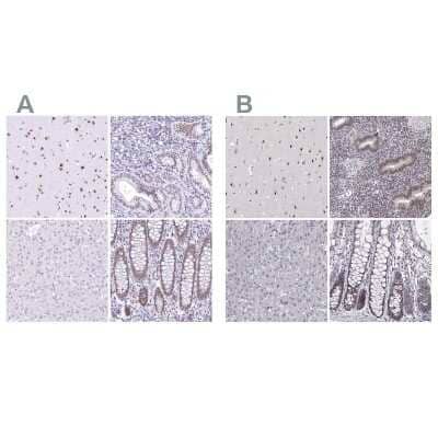Immunohistochemistry-Paraffin: HNRNPA0 Antibody [NBP1-83240] - Staining of human cerebral cortex, endometrium, liver and lower gastrointestinal using Anti-HNRNPA0 antibody NBP1-83240 (A) shows similar protein distribution across tissues to independent antibody NBP2-55847 (B).