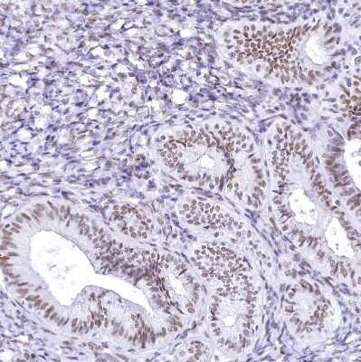 Immunohistochemistry-Paraffin: HNRNPA0 Antibody [NBP1-83240] - Staining of human endometrium shows moderate nuclear positivity in glandular cells.