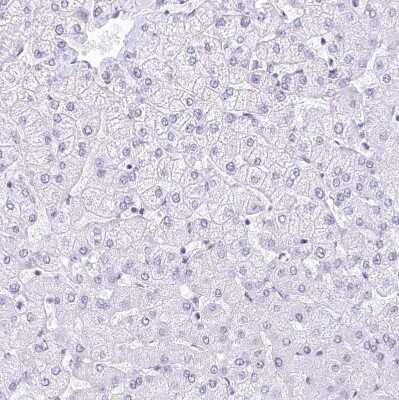 Immunohistochemistry-Paraffin: HNRNPA0 Antibody [NBP1-83240] - Staining of human liver shows no nuclear positivity in hepatocytes as expected.