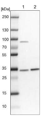 <b>Independent Antibodies Validation. </b>Western Blot: HNRNPA0 Antibody [NBP1-83240] - Lane 1: NIH-3T3 cell lysate (Mouse embryonic fibroblast cells). Lane 2: NBT-II cell lysate (Rat Wistar bladder tumor cells).
