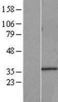 Western Blot: HNRNPA0 Overexpression Lysate (Adult Normal) [NBL1-11634] Left-Empty vector transfected control cell lysate (HEK293 cell lysate); Right -Over-expression Lysate for HNRNPA0.