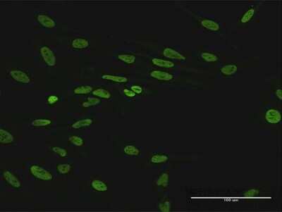 Immunocytochemistry/Immunofluorescence: HNRNPUL1 Antibody [H00011100-B01P] - Analysis of purified antibody to HNRNPUL1 on HeLa cell. (antibody concentration 10 ug/ml)