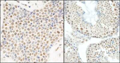<b>Independent Antibodies Validation and Biological Strategies Validation.</b>Immunohistochemistry-Paraffin: HNRNPUL1 Antibody [NB110-40586] - Sample: FFPE section of human small cell lung cancer (left) and mouse testis (right). Antibody: Affinity purified rabbit anti-E1B-AP5 used at a dilution of 1:200 (1ug/ml). Detection: DAB