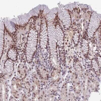 Immunohistochemistry-Paraffin: HNRNPUL1 Antibody [NBP2-47431] - Staining of human stomach shows moderate nuclear positivity in glandular cells.