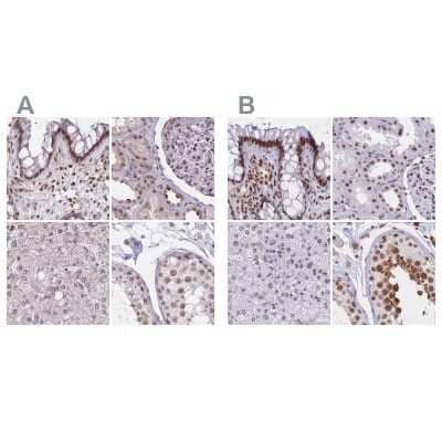 <b>Independent Antibodies Validation. </b>Immunohistochemistry-Paraffin: HNRNPUL1 Antibody [NBP2-47431] - Staining of human colon, kidney, liver and testis using Anti-HNRNPUL1 antibody NBP2-47431 (A) shows similar protein distribution across tissues to independent antibody NBP2-47432 (B).