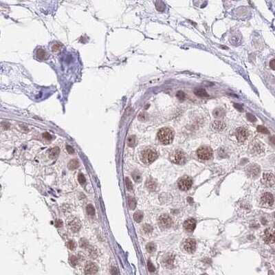Immunohistochemistry-Paraffin: HNRNPUL1 Antibody [NBP2-47431] - Staining of human testis.