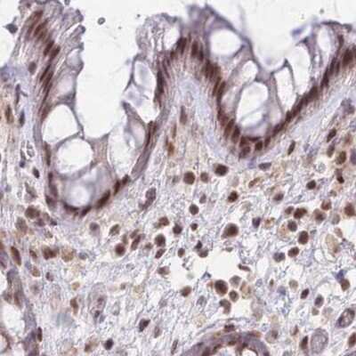 Immunohistochemistry-Paraffin: HNRNPUL1 Antibody [NBP2-47431] - Staining of human colon.