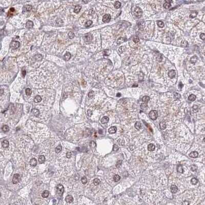 Immunohistochemistry-Paraffin: HNRNPUL1 Antibody [NBP2-47431] - Staining of human liver.
