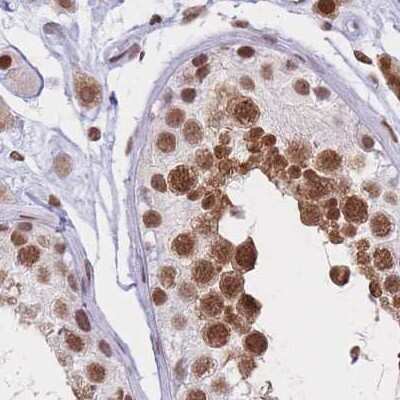 Immunohistochemistry-Paraffin: HNRNPUL1 Antibody [NBP2-47432] - Staining of human testis.