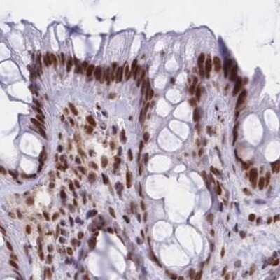Immunohistochemistry-Paraffin: HNRNPUL1 Antibody [NBP2-47432] - Staining of human colon.
