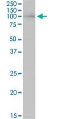 Western Blot: HNRNPUL1 Antibody [H00011100-B01P] - Analysis of HNRNPUL1 expression in human placenta.
