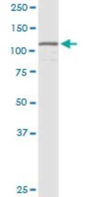 Western Blot: HNRNPUL1 Antibody [H00011100-D01P] - Analysis of HNRNPUL1 expression in human pancreas.