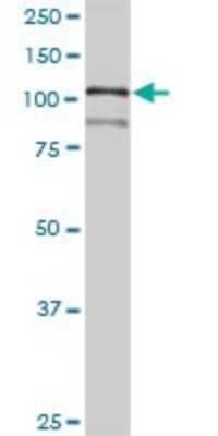 Western Blot: HNRNPUL1 Antibody [H00011100-D01P] - Analysis of HNRNPUL1 expression in mouse spleen.